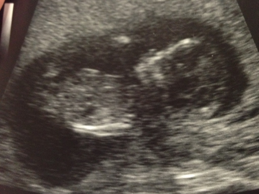 Name:  ImageUploadedByTapatalk1357597768.221487.jpg
Views: 98
Size:  149.6 KB