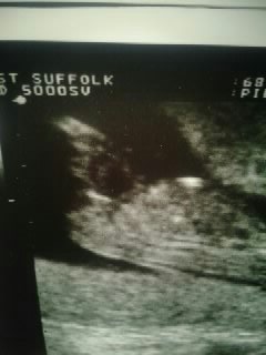 Name:  12weeks4days2.jpg
Views: 135
Size:  29.0 KB