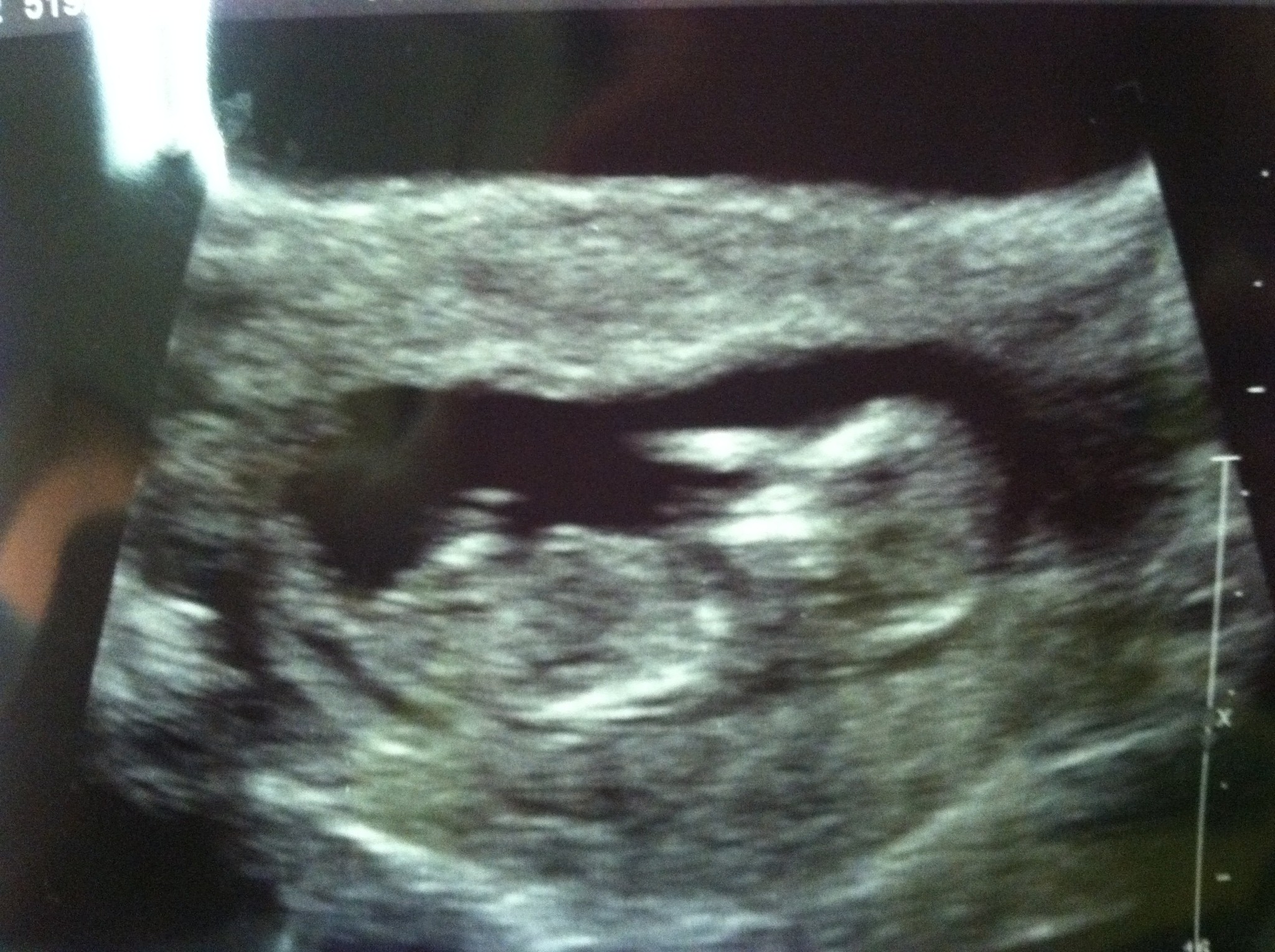 Name:  13 weeks-3.jpg
Views: 427
Size:  739.0 KB