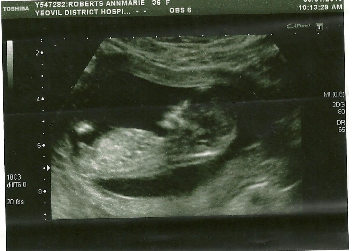 Name:  babyscannew.jpg
Views: 177
Size:  133.1 KB