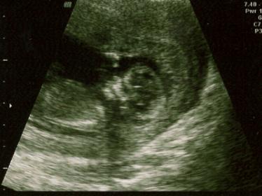 Name:  Screen shot 2013-01-15 at 9.50.19 PM.jpg
Views: 244
Size:  17.0 KB