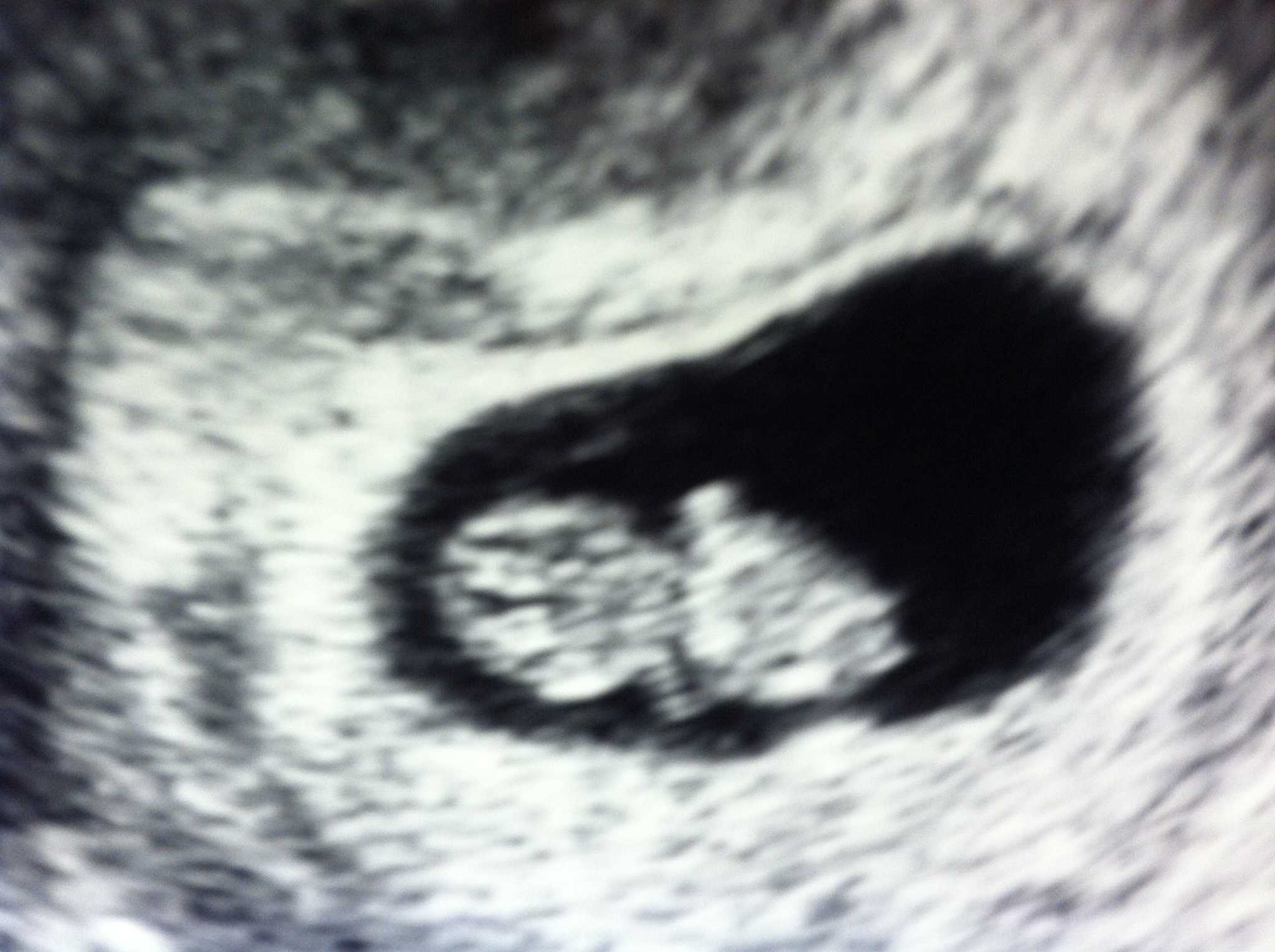 Name:  12 weeks.jpg
Views: 246
Size:  791.9 KB