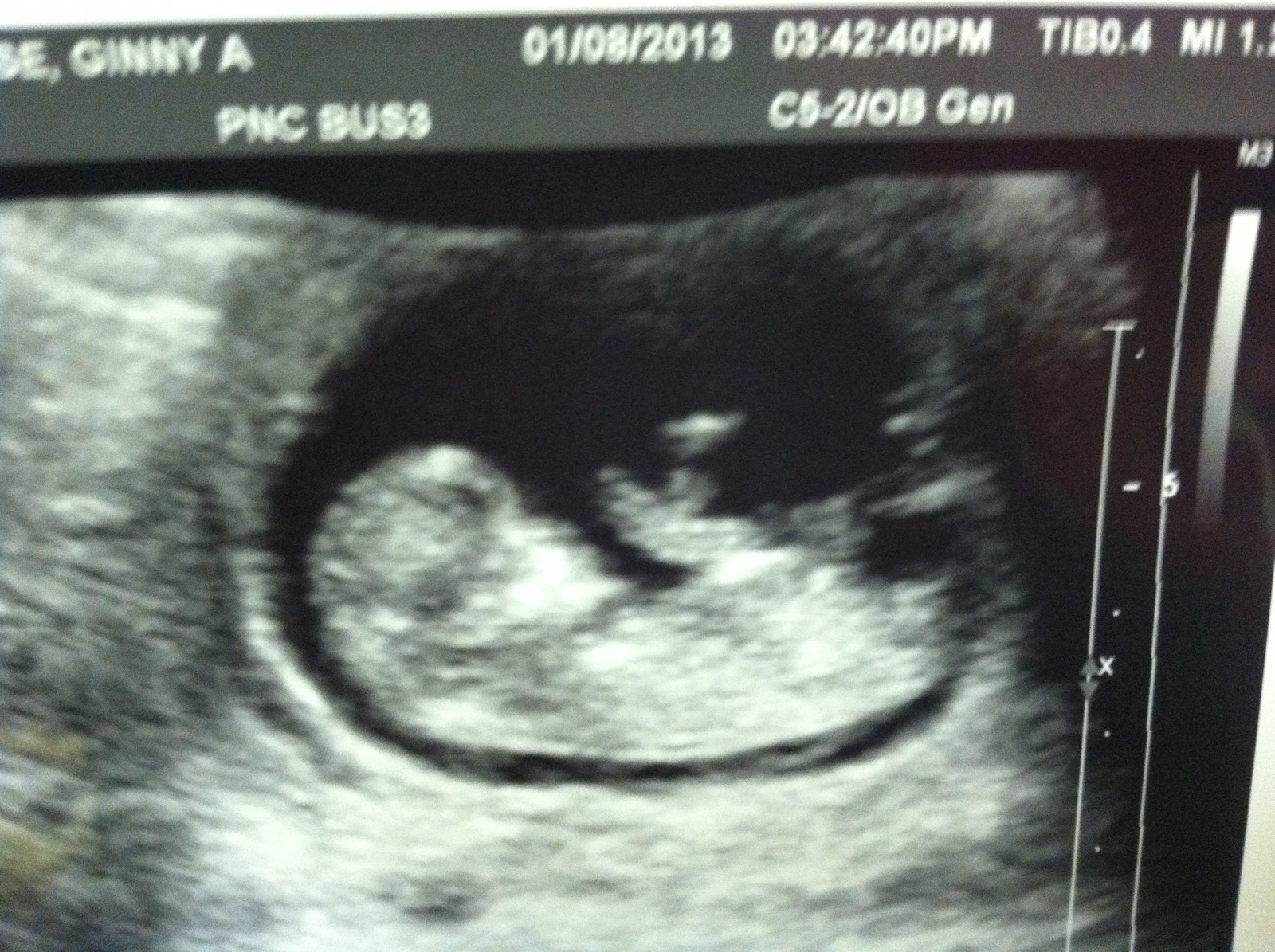 Name:  Baby # 3 January.jpg
Views: 690
Size:  649.1 KB
