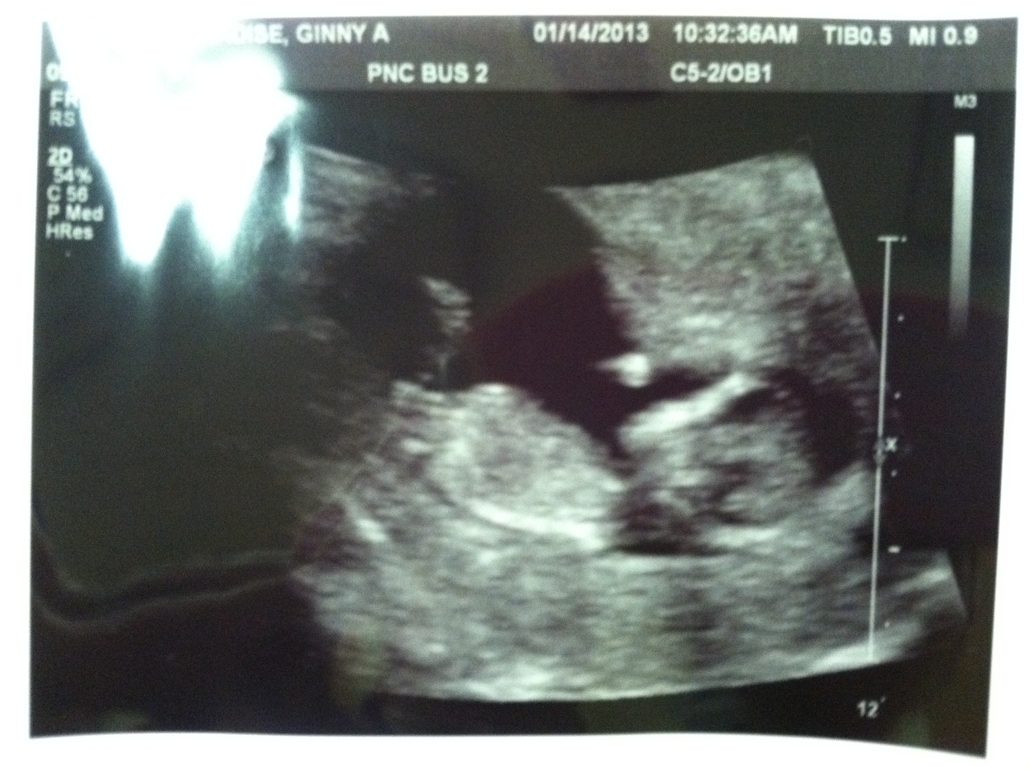 Name:  13 weeks-2.jpg
Views: 280
Size:  684.6 KB