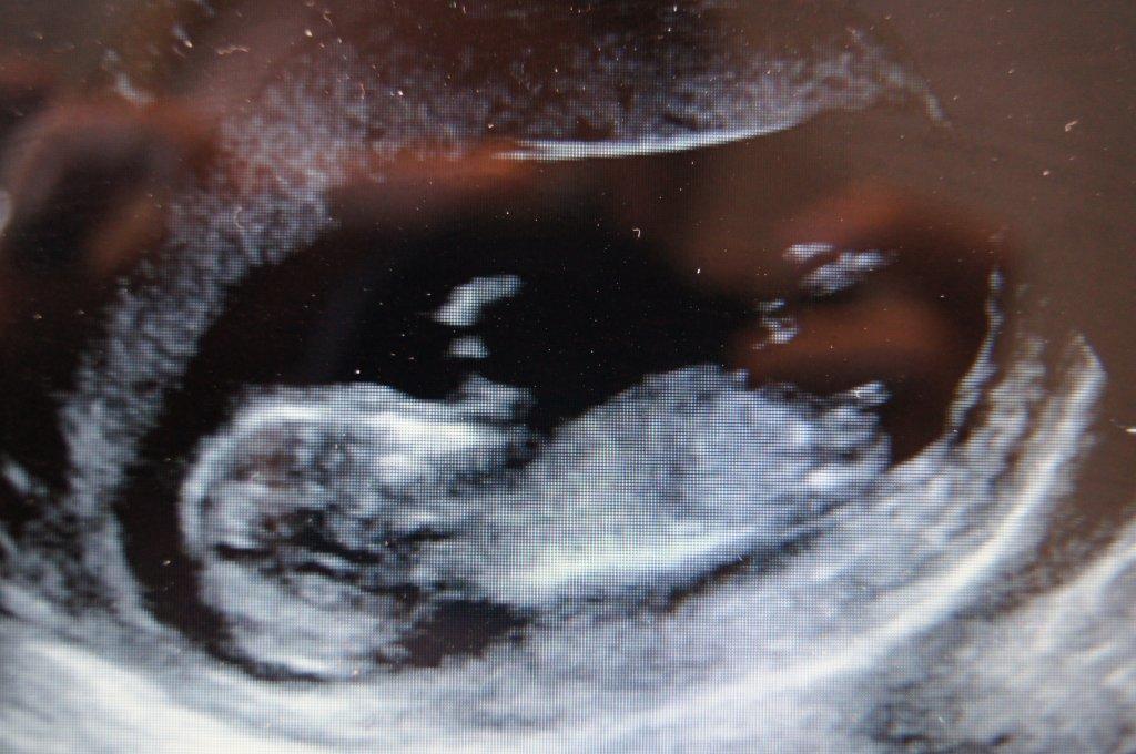 Name:  Baby2.jpg
Views: 171
Size:  104.9 KB