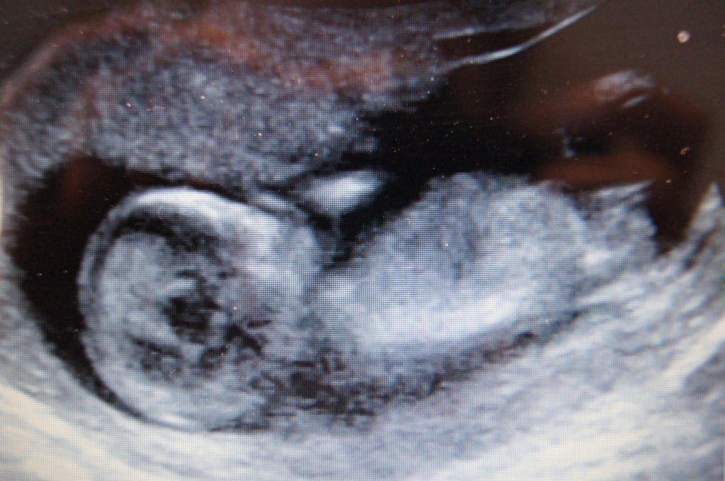 Name:  Baby3.jpg
Views: 137
Size:  105.9 KB