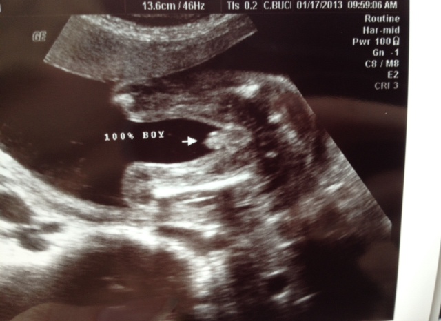 Name:  21week.JPG
Views: 2904
Size:  97.0 KB