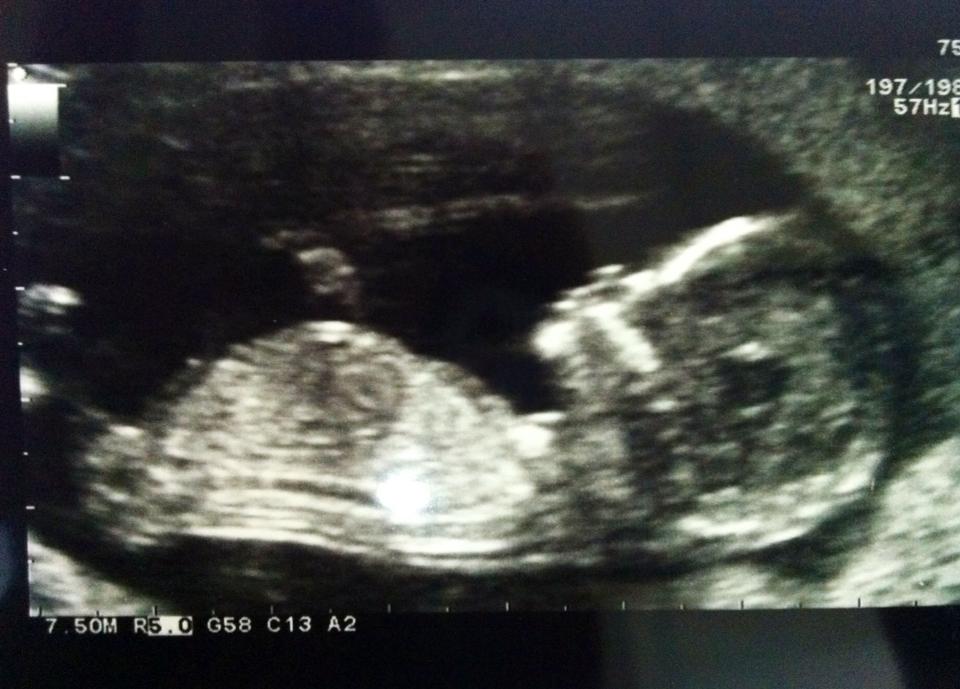 Name:  baby.jpg
Views: 274
Size:  70.7 KB