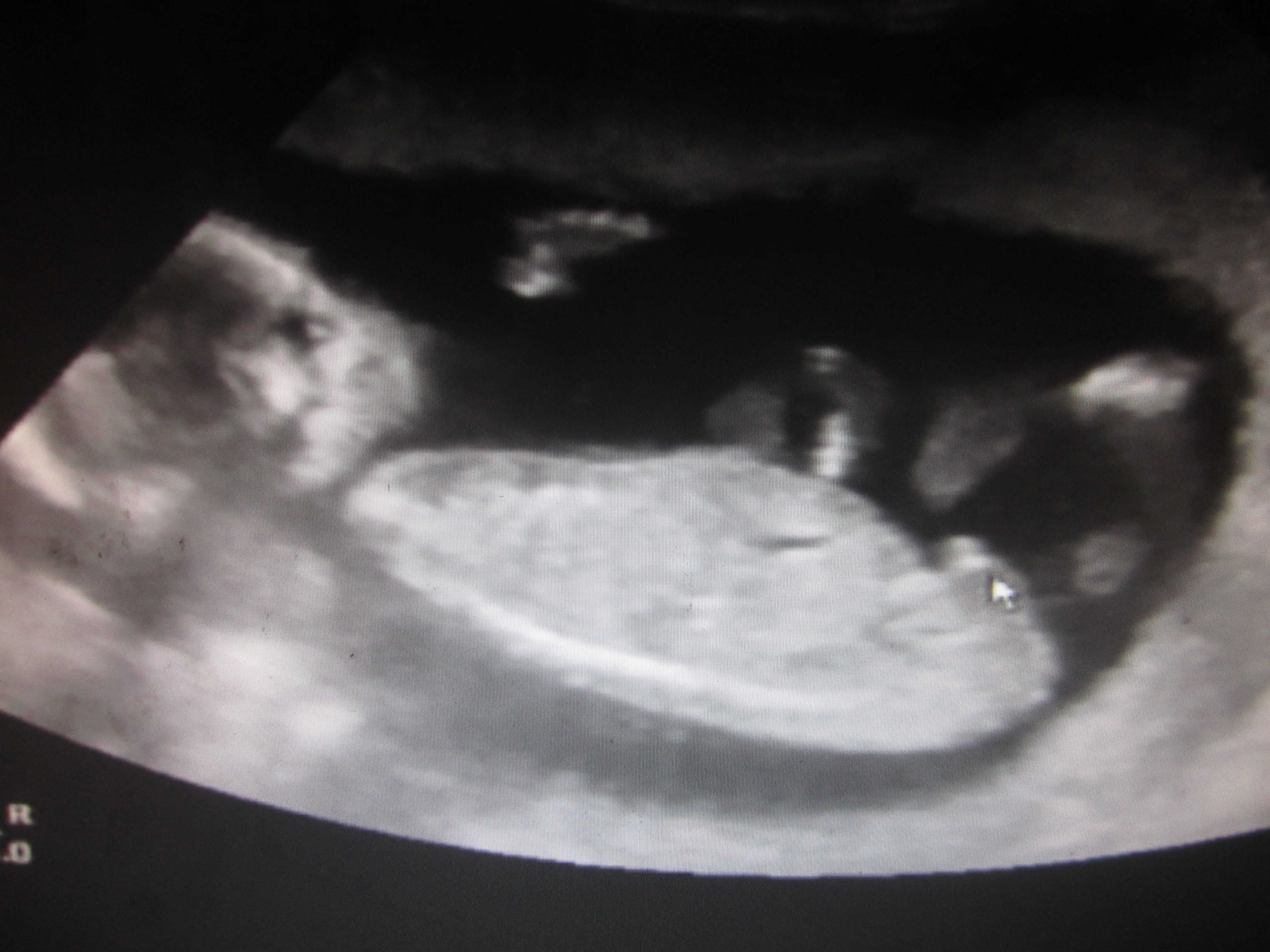 Name:  aIUscan 002.JPG
Views: 4473
Size:  3.17 MB