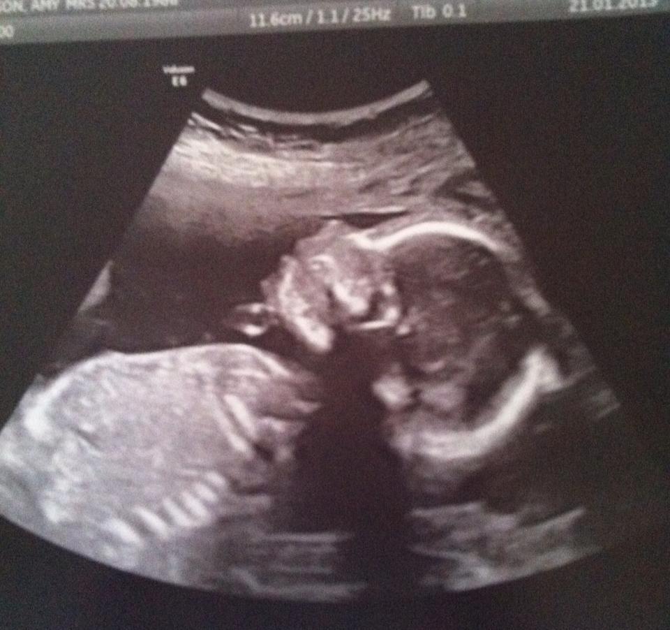 Name:  baby.jpg
Views: 109
Size:  92.0 KB