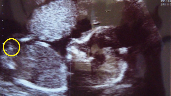 Name:  baby.jpg
Views: 118
Size:  95.8 KB