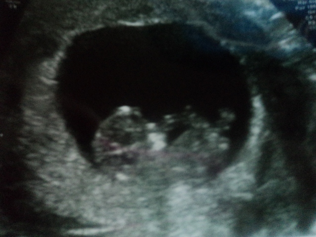 Name:  play & 9+4 scan 020 (640x480).jpg
Views: 112
Size:  173.3 KB