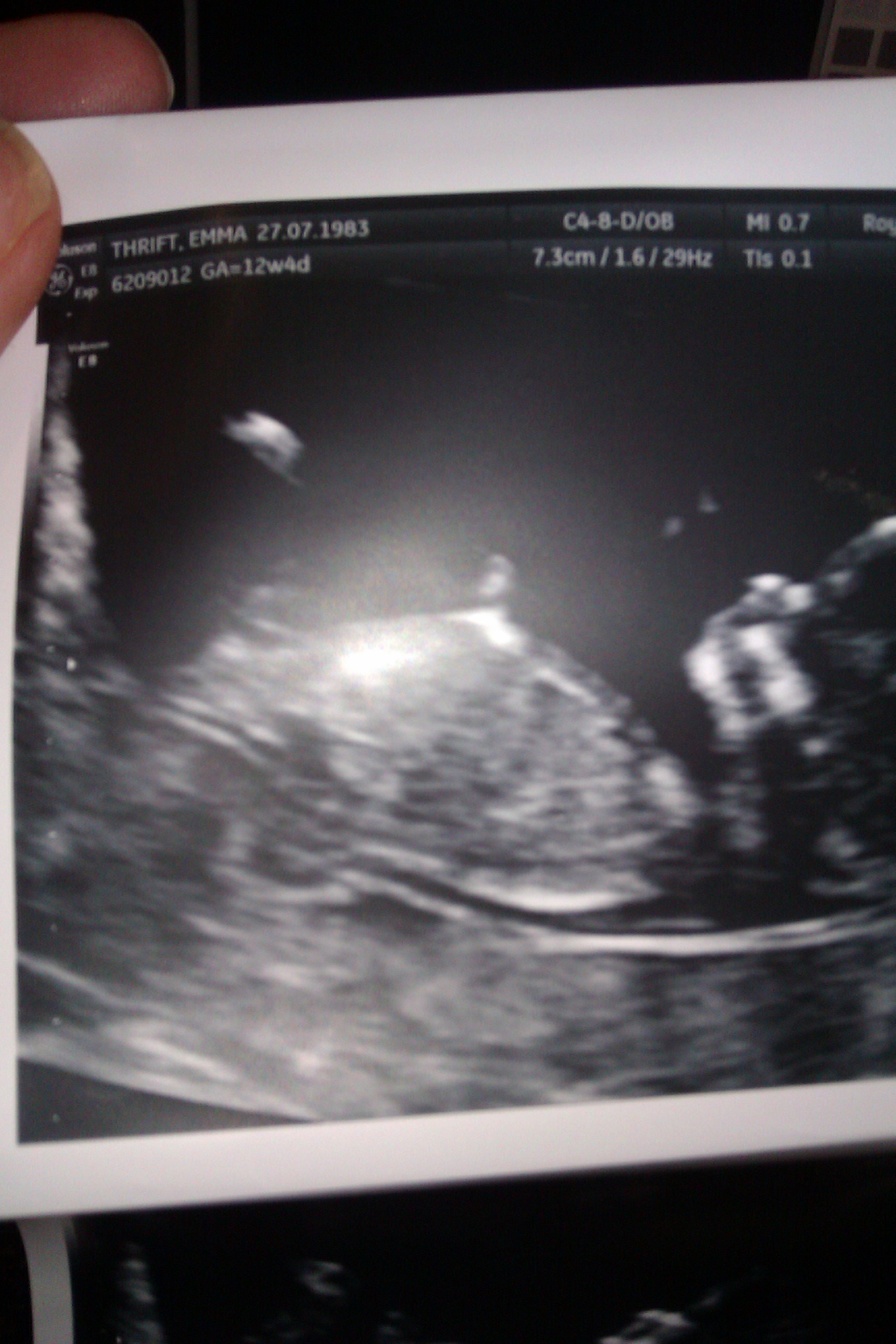 Name:  IMAG0188.jpg
Views: 759
Size:  647.1 KB