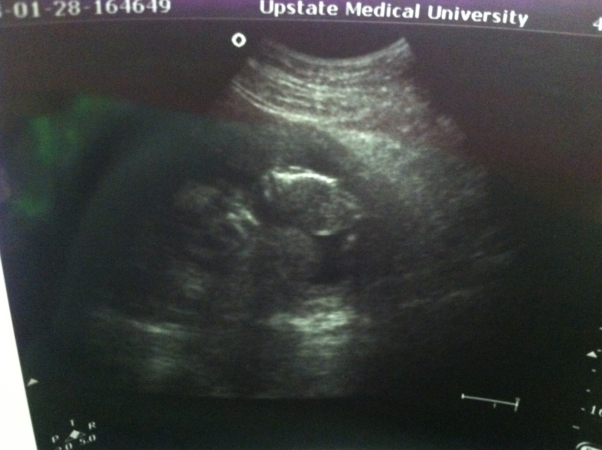 Name:  15 weeks.jpg
Views: 275
Size:  985.9 KB