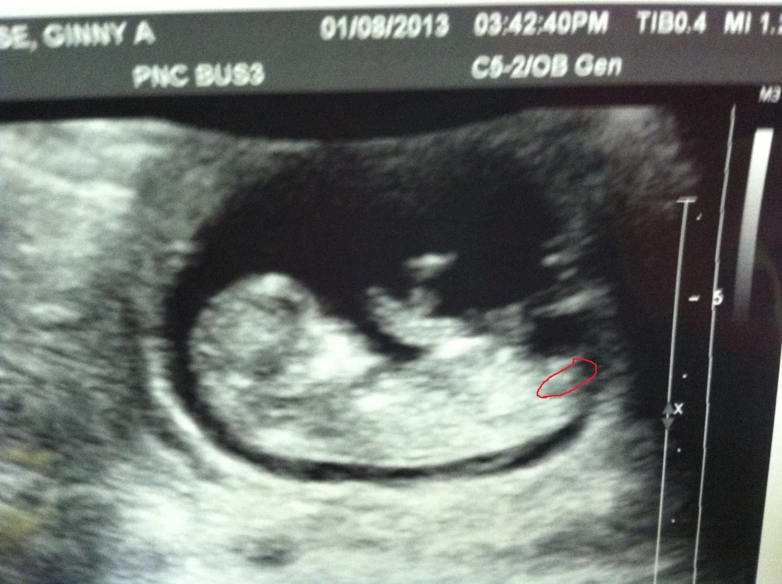 Name:  Baby # 3 January.jpg
Views: 495
Size:  645.9 KB