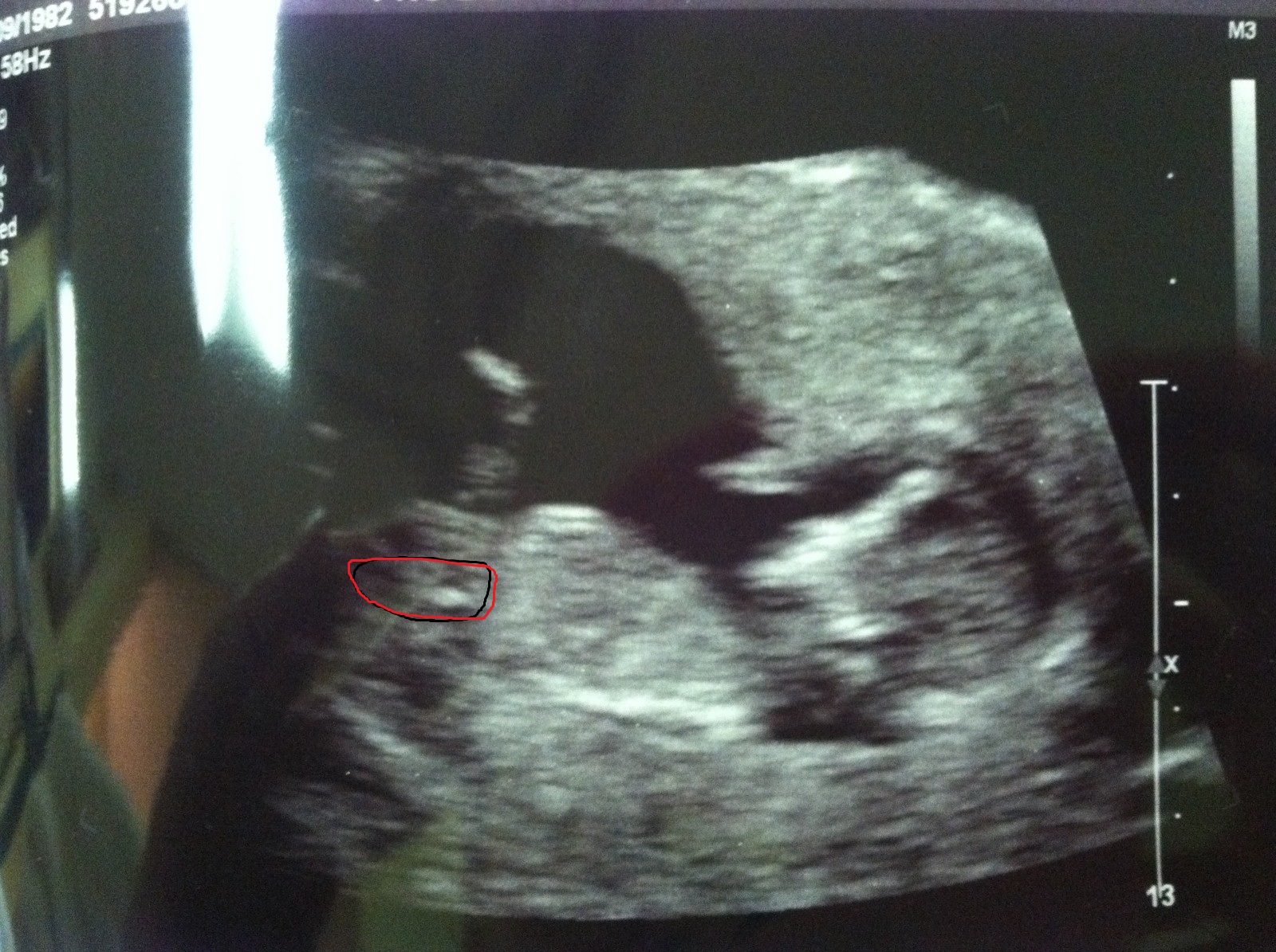 Name:  13 weeks-1.jpg
Views: 115
Size:  602.1 KB