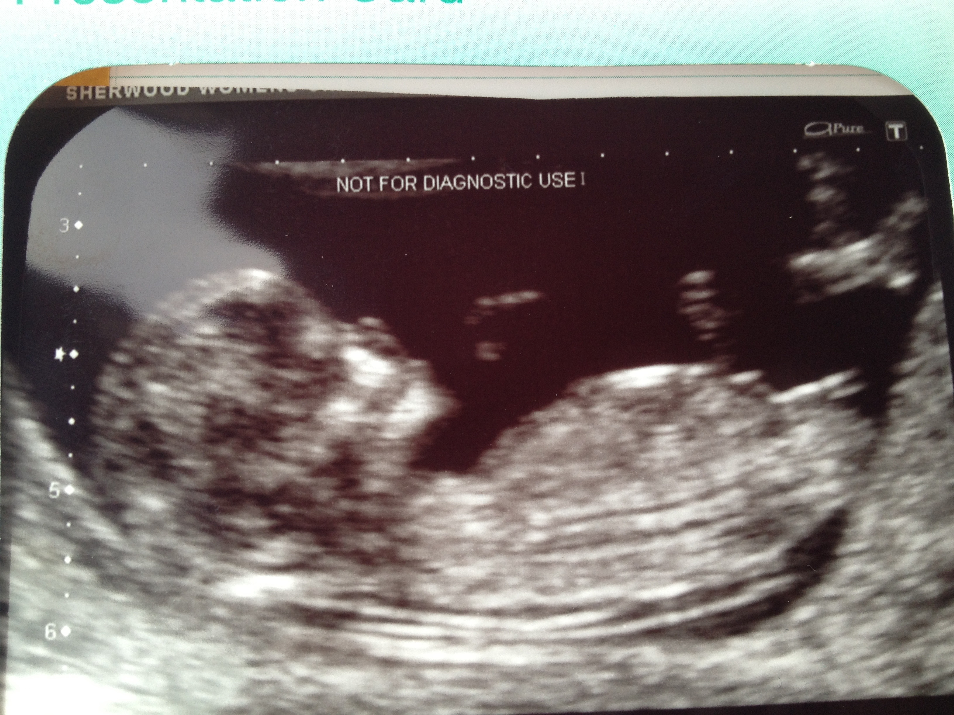 Name:  image.jpg
Views: 6727
Size:  2.08 MB