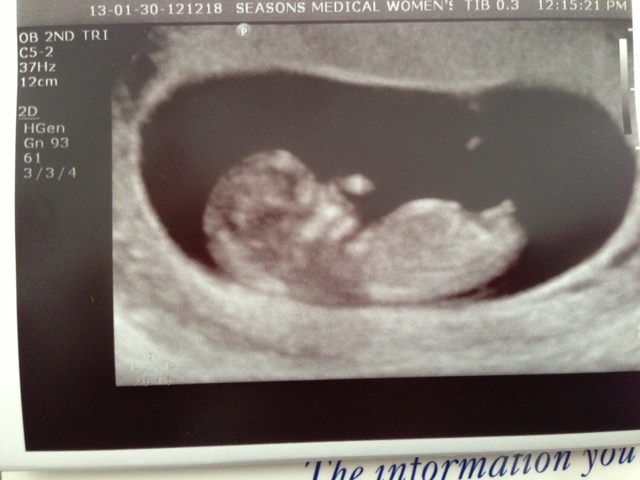 Name:  ultrasound.jpg
Views: 134
Size:  98.1 KB