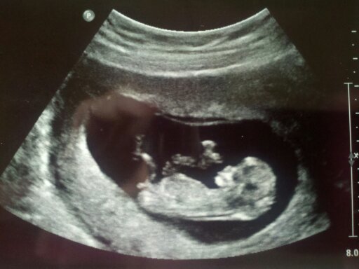 Name:  baby2413 007.jpg
Views: 139
Size:  37.8 KB