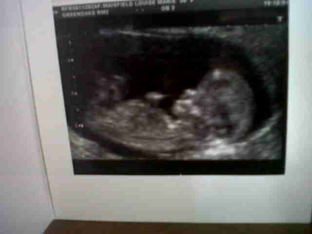 Name:  baby 011.jpg
Views: 129
Size:  18.5 KB