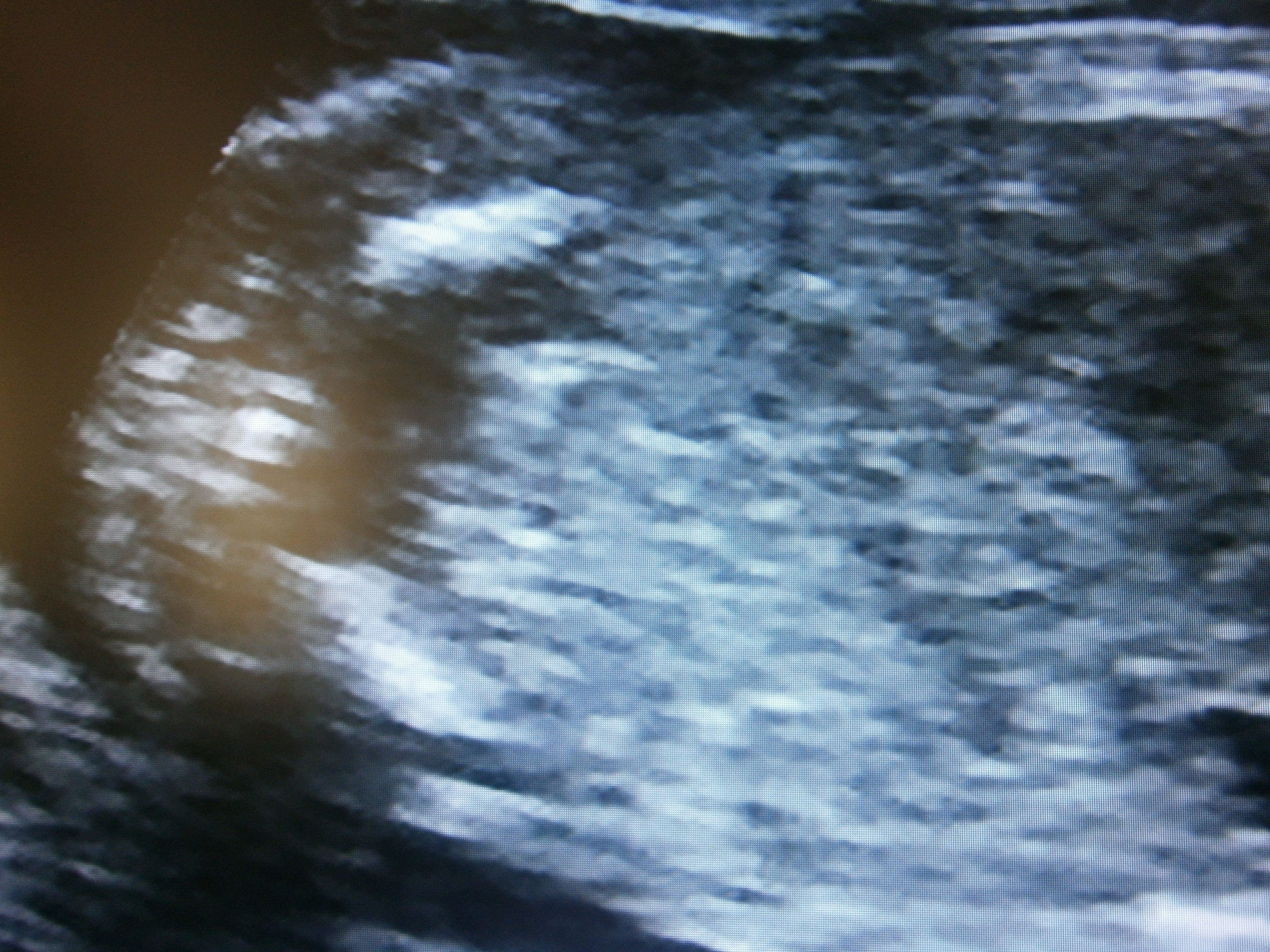 Name:  ultrasound pics 003.jpg
Views: 583
Size:  3.31 MB