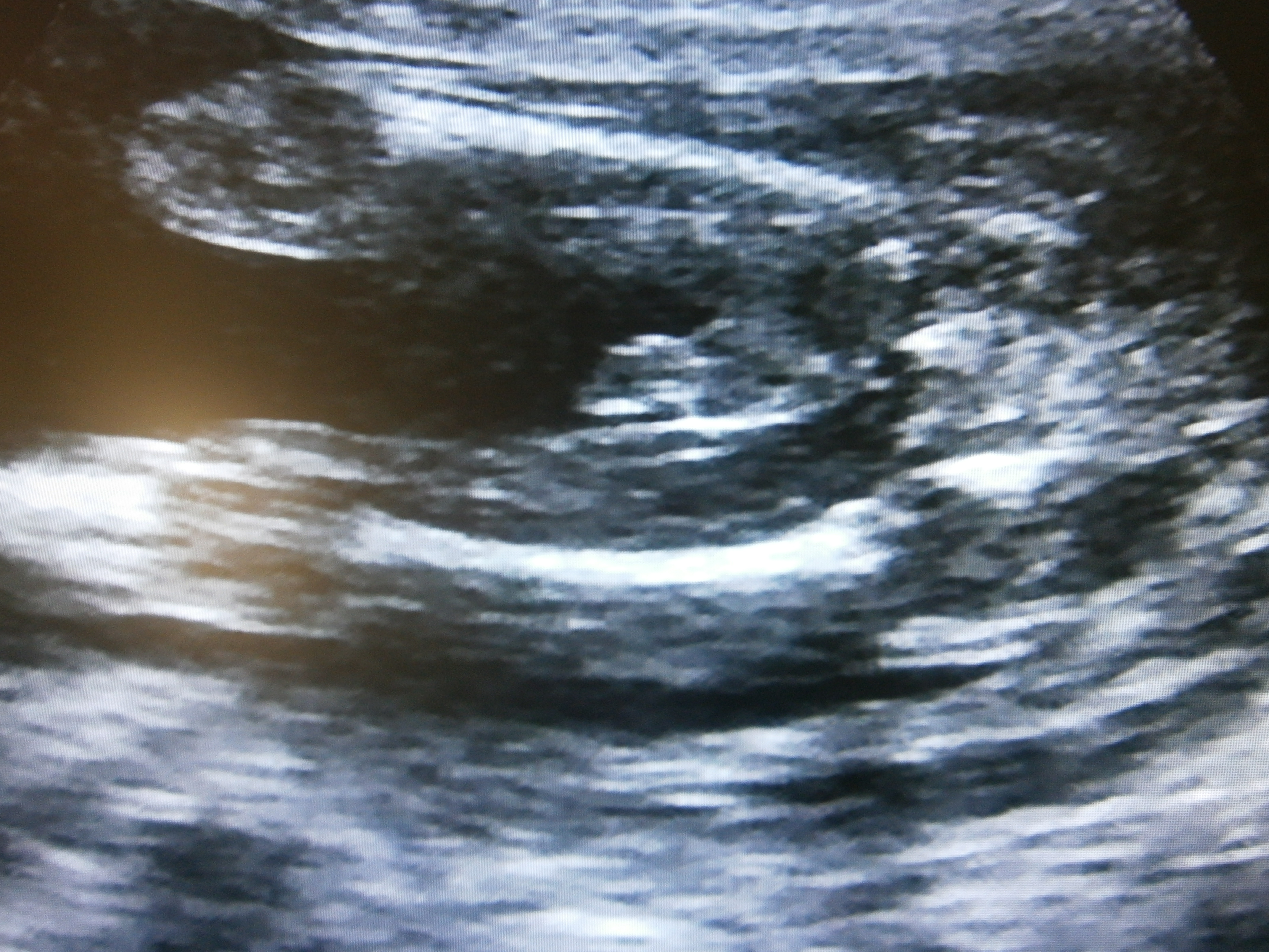 Name:  ultrasound pics 010.jpg
Views: 928
Size:  3.38 MB