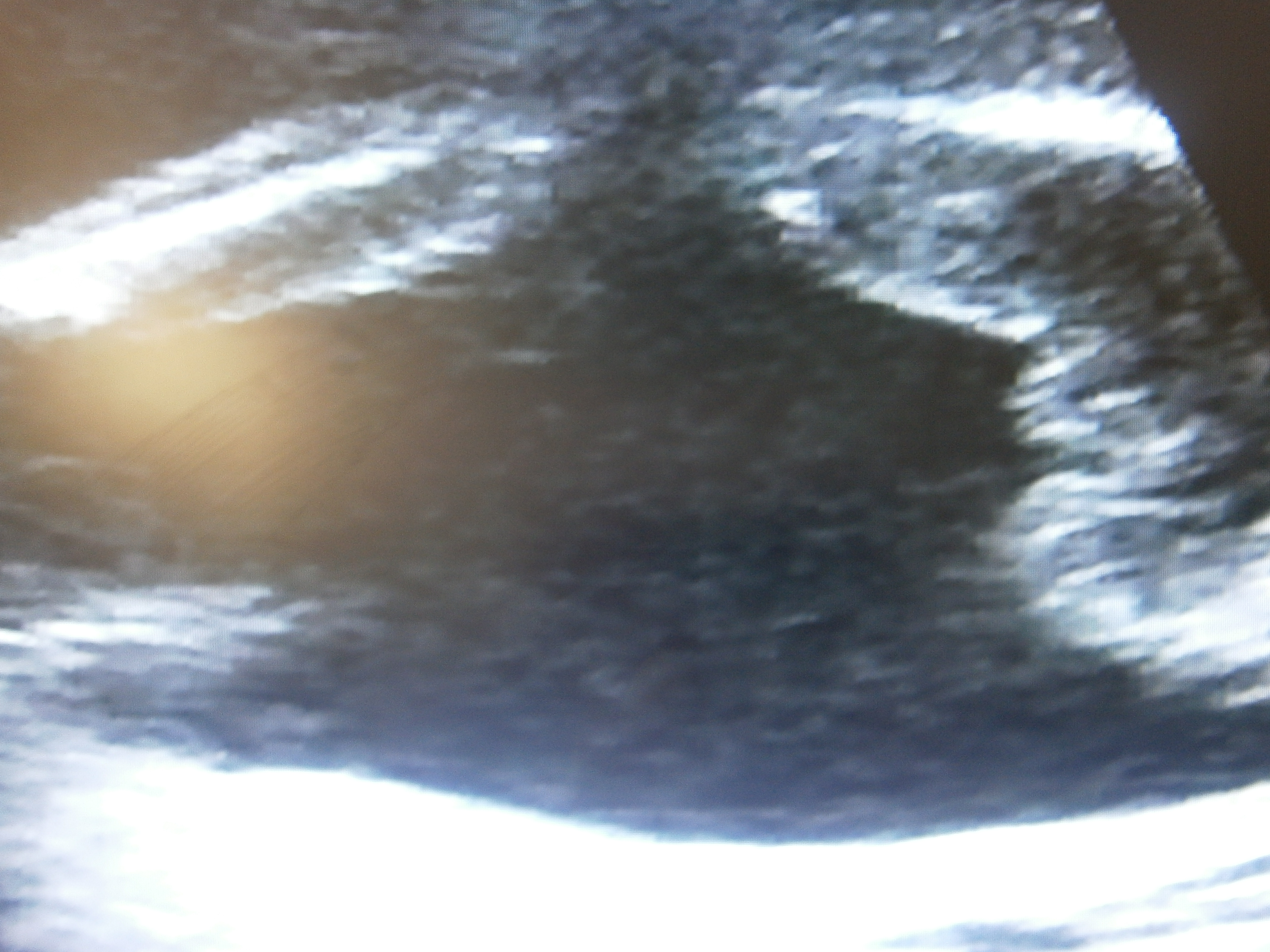 Name:  ultrasound pics 012.jpg
Views: 507
Size:  3.43 MB