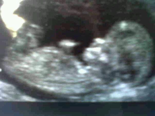 Name:  407579_4952219776916_1595128203_nbaby.jpg
Views: 121
Size:  25.9 KB
