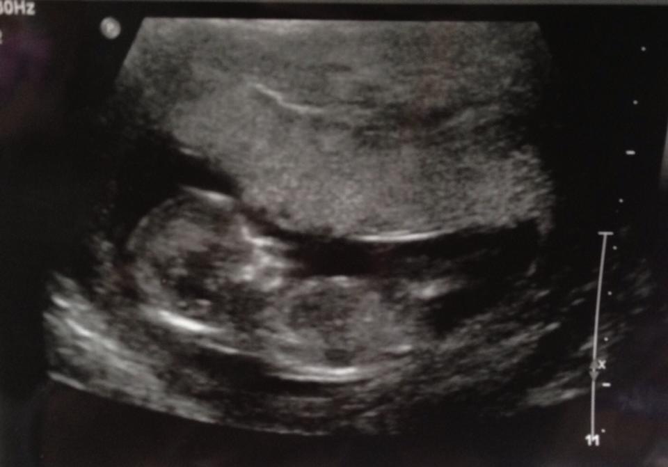 Name:  12 weeks.jpg
Views: 94
Size:  75.3 KB