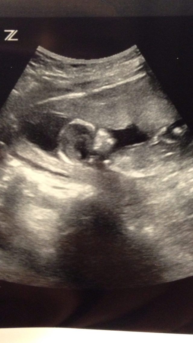 Name:  13 weeks.JPG
Views: 111
Size:  428.2 KB