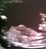 Name:  babyclose.jpg
Views: 109
Size:  18.9 KB