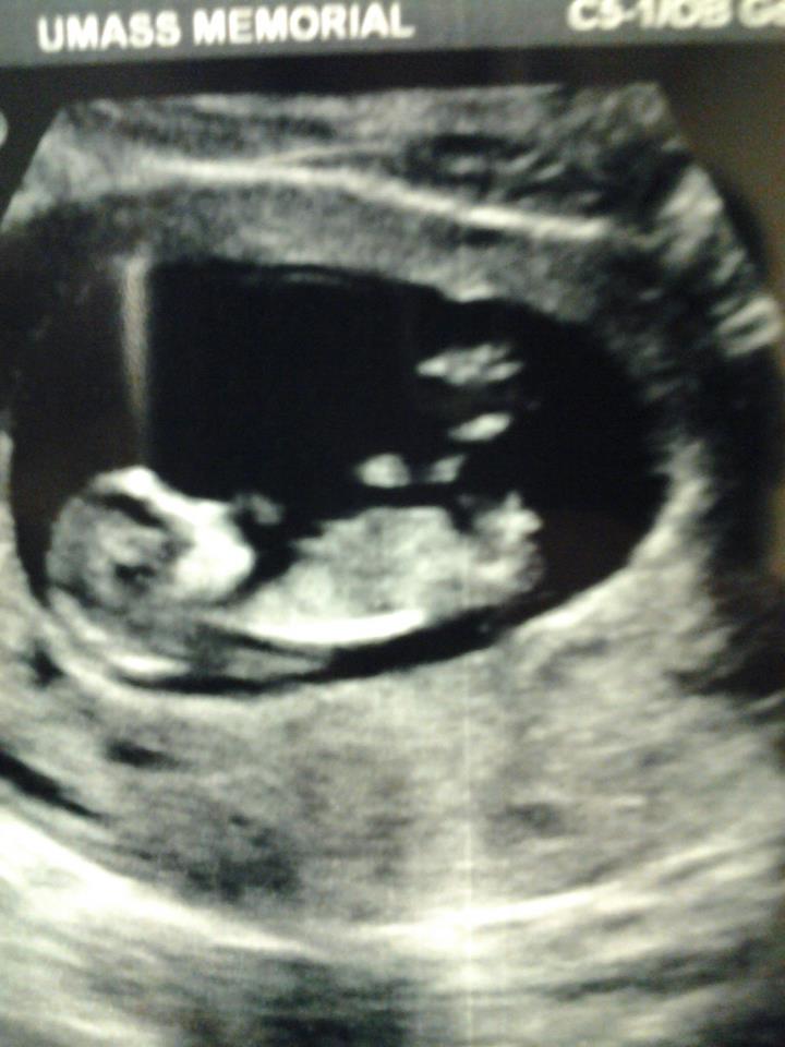 Name:  baby 1.jpg
Views: 105
Size:  62.4 KB