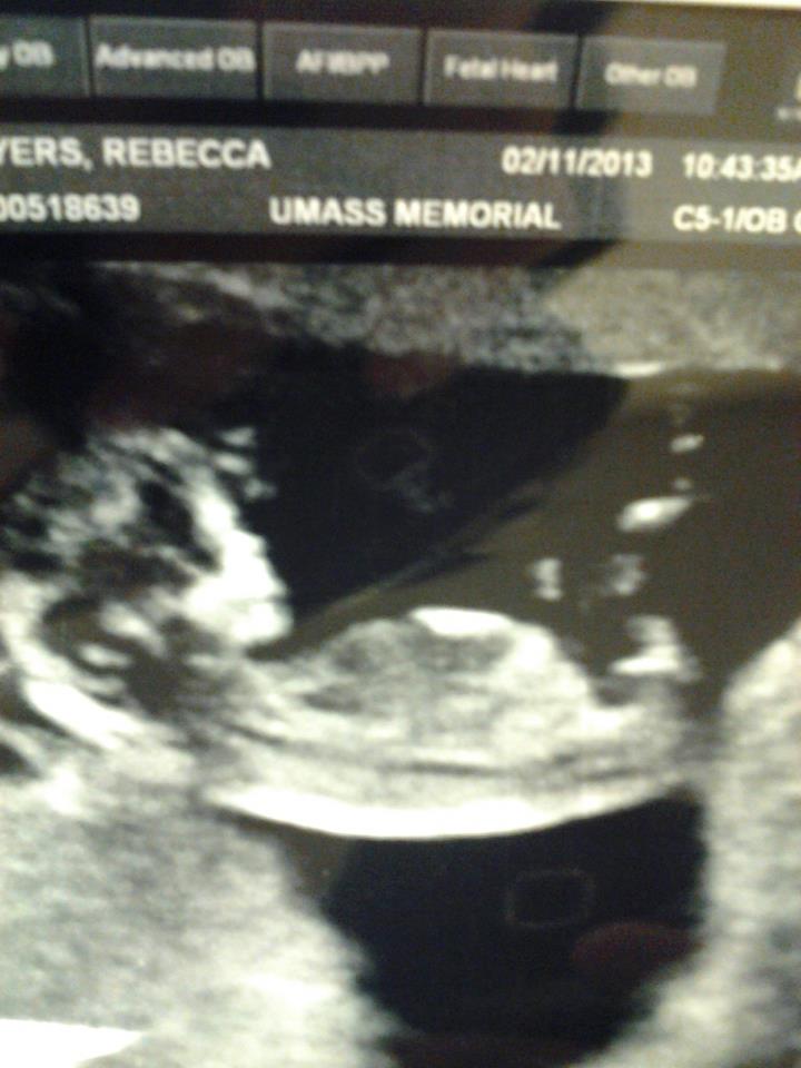 Name:  Baby 2.jpg
Views: 105
Size:  62.2 KB