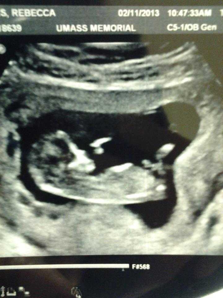 Name:  baby3.jpg
Views: 75
Size:  70.1 KB