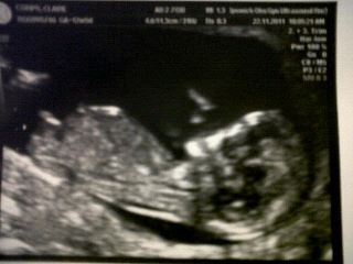 Name:  baby scan.jpg
Views: 222
Size:  12.6 KB