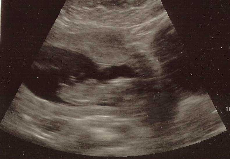 Name:  baby5-4.JPG
Views: 368
Size:  42.0 KB