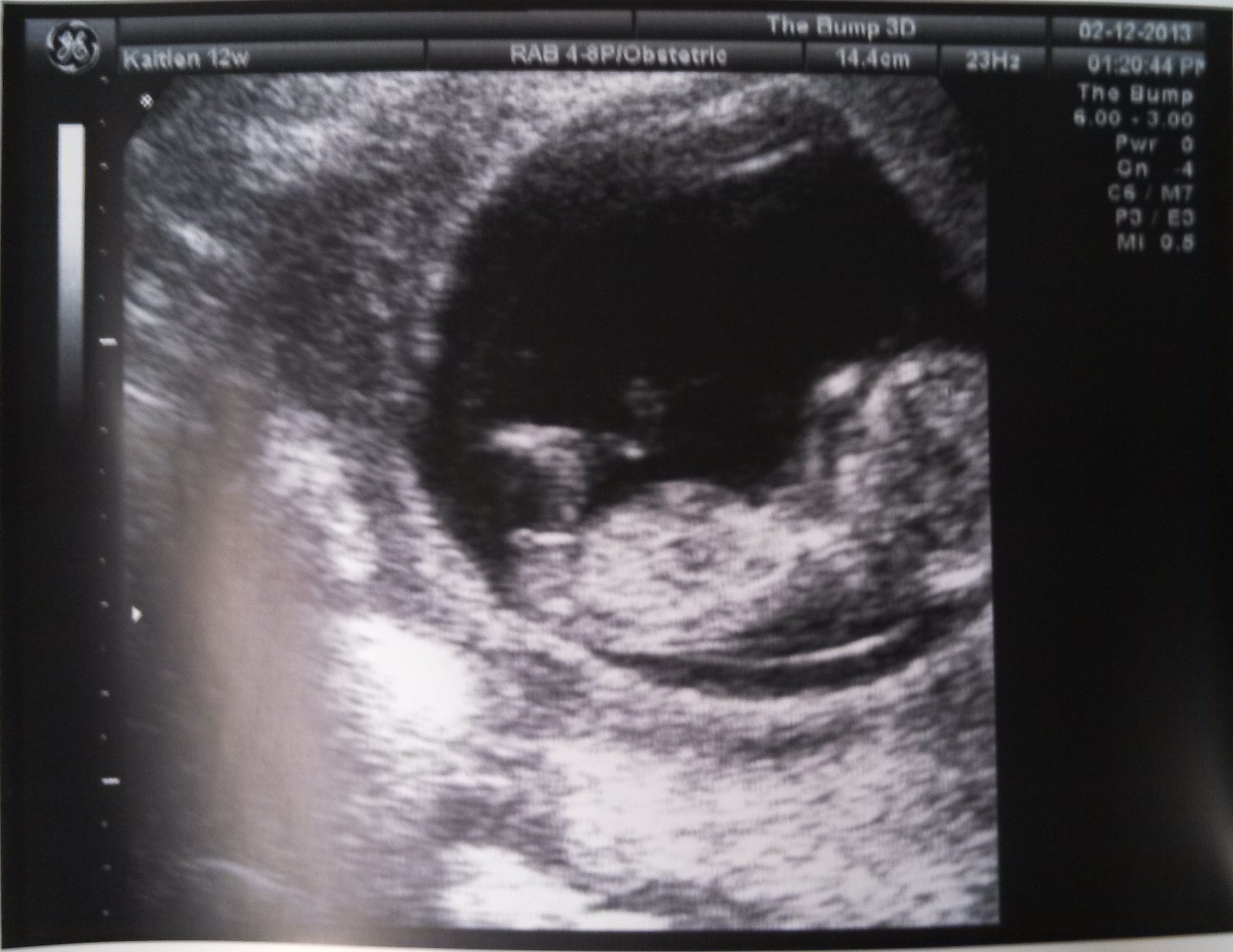 Name:  Baby IV.jpg
Views: 205133
Size:  932.1 KB