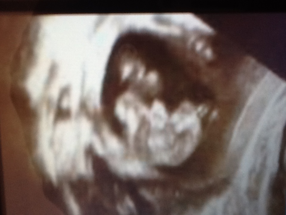 Name:  image.jpg
Views: 183
Size:  154.6 KB