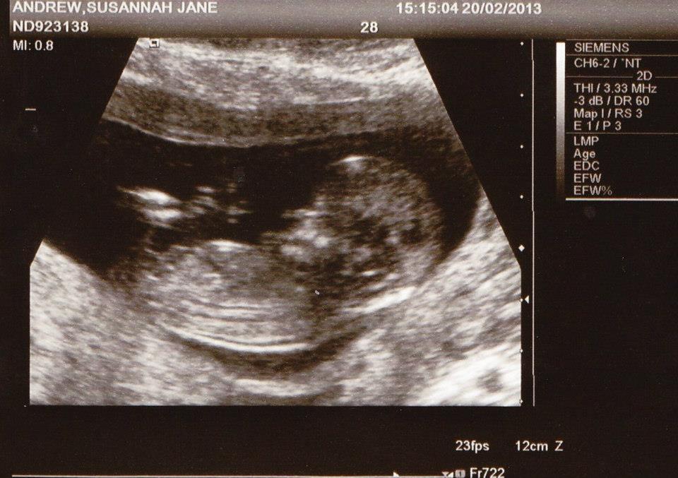 Name:  soozscan1.jpg
Views: 147
Size:  89.7 KB