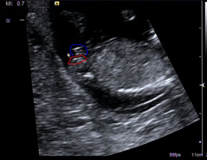 Name:  nub12.JPG
Views: 193
Size:  48.1 KB