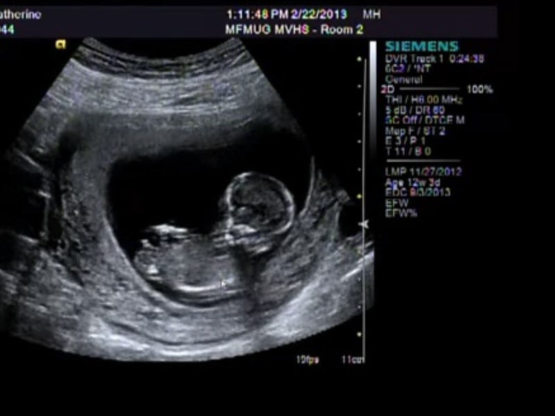 Name:  boybest.jpg
Views: 284
Size:  48.5 KB