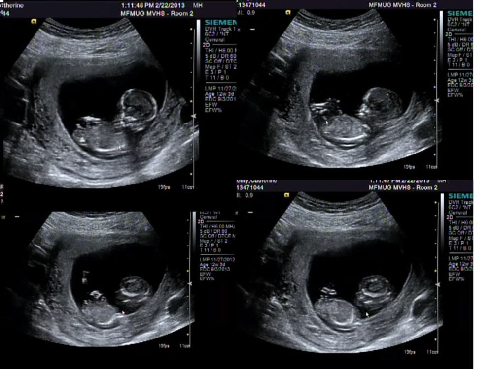 Name:  boycollage.jpg
Views: 262
Size:  102.1 KB