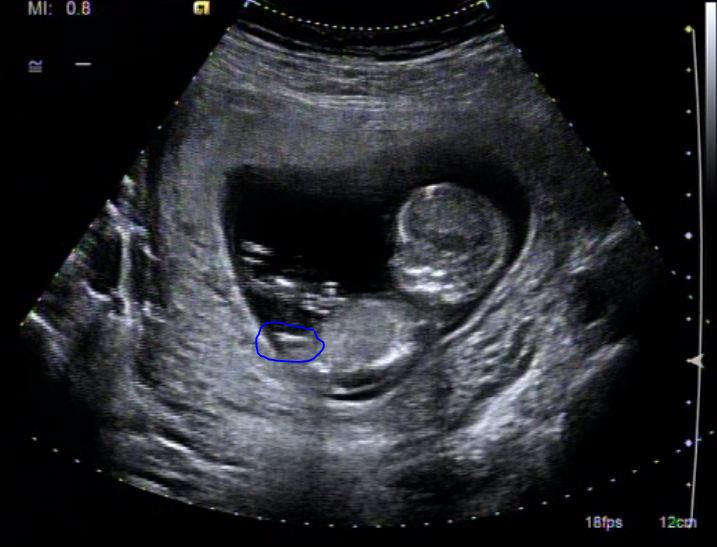 Name:  nub15.JPG
Views: 192
Size:  57.6 KB