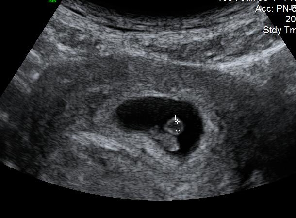 Name:  Baby 7 weeks0006 (2).jpg
Views: 13605
Size:  138.3 KB