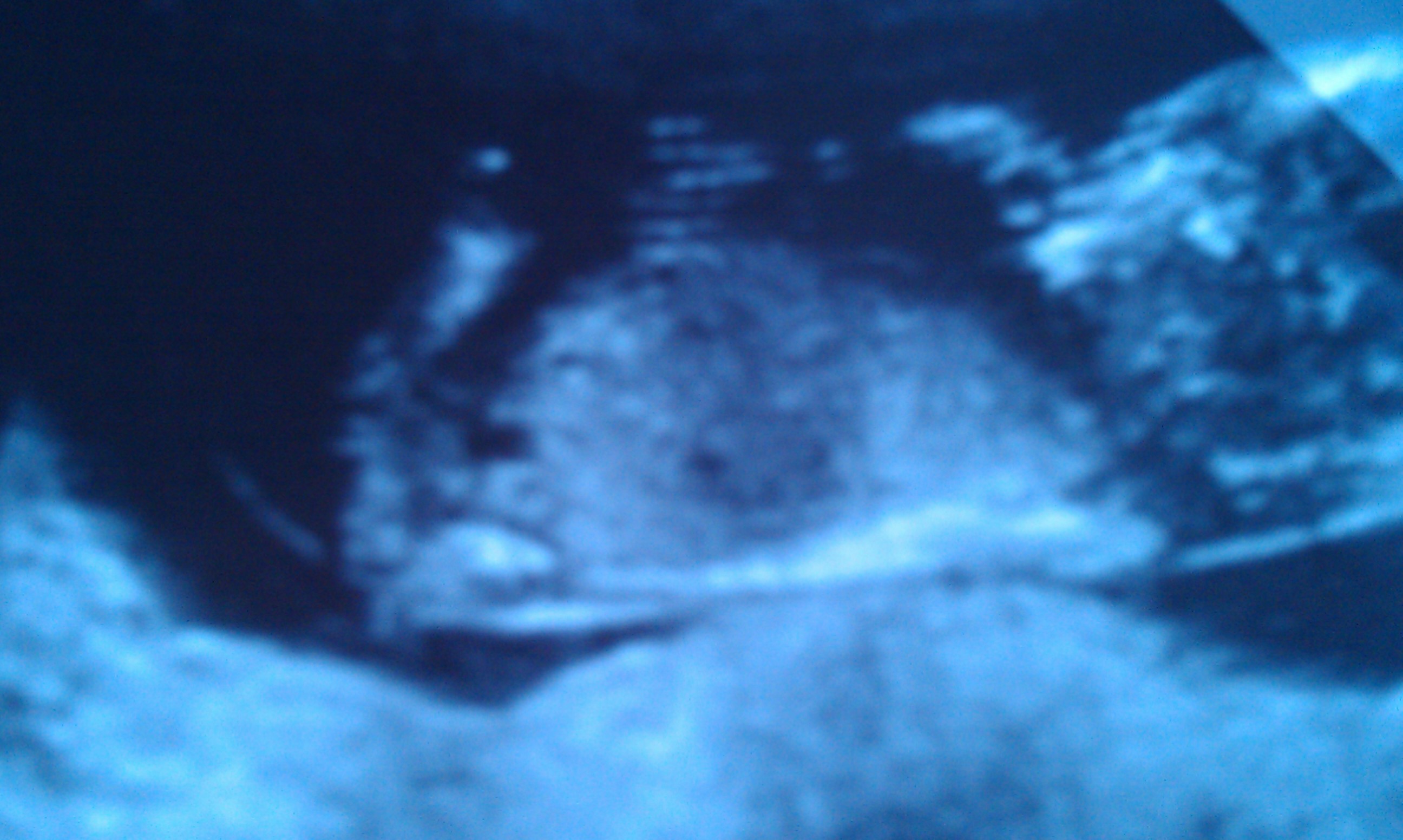 Name:  IMAG0992.jpg
Views: 225
Size:  488.1 KB