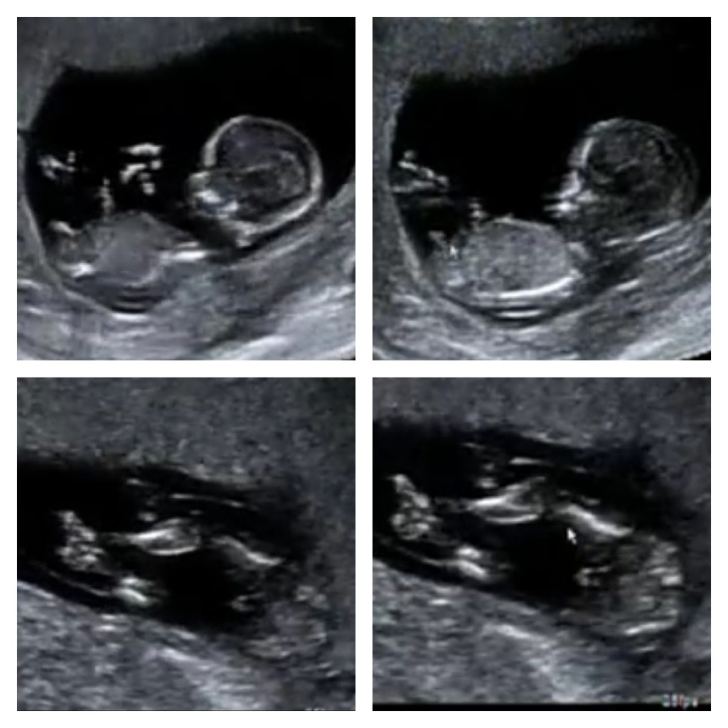 Name:  ImageUploadedByTapatalk1363154725.578237.jpg
Views: 211
Size:  140.5 KB