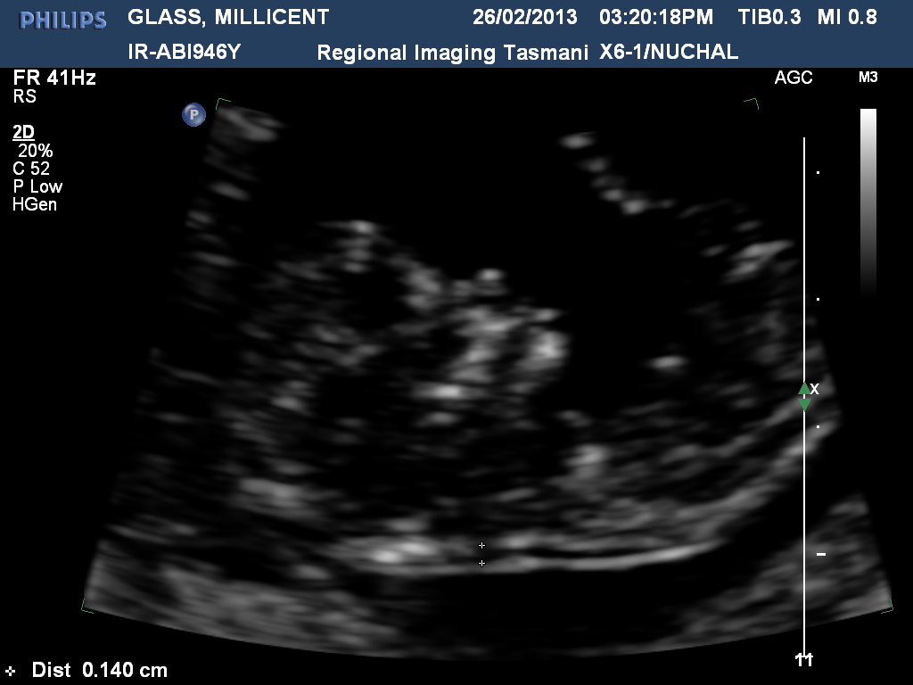 Name:  GLASSMILLICENT20130226152019117.jpg
Views: 178
Size:  123.9 KB