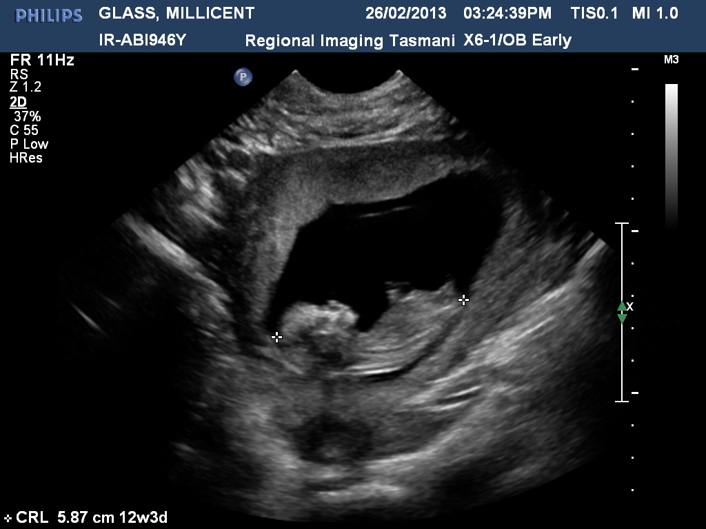 Name:  GLASSMILLICENT20130226152439786.jpg
Views: 154
Size:  160.6 KB