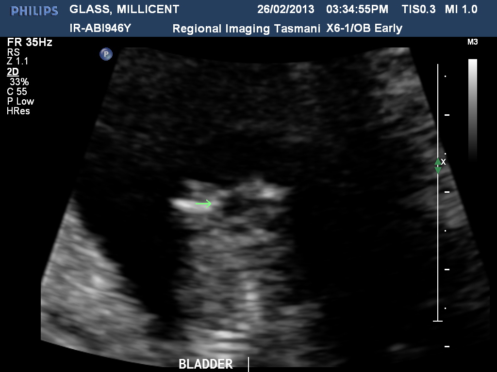 Name:  GLASSMILLICENT20130226153455740.jpg
Views: 173
Size:  133.5 KB