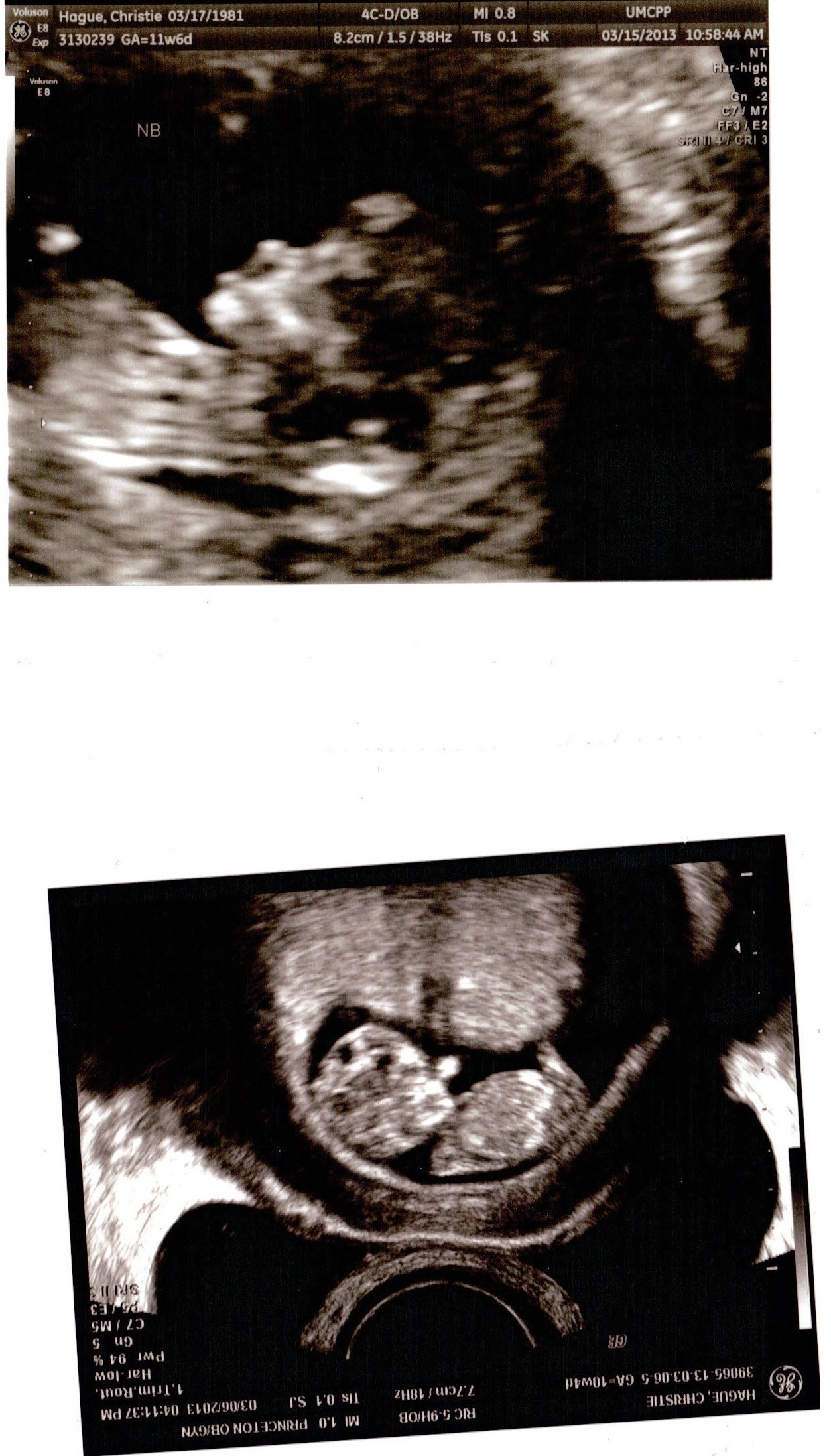 Name:  ultrasound pic.jpg
Views: 82
Size:  963.3 KB